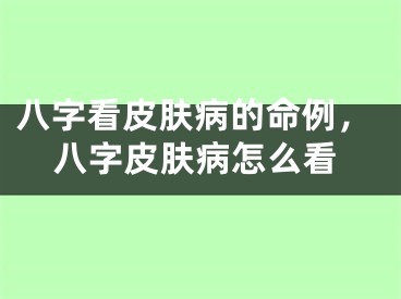 八字看皮肤病的命例,八字皮肤病怎么看
