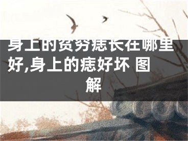 身上的贫穷痣长在哪里好,身上的痣好坏 图解 